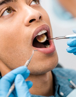 Man receiving dental checkup in Mount Pleasant
