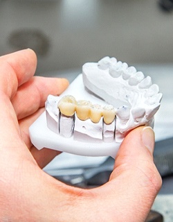 Dental bridge in Mount Pleasant on clay model