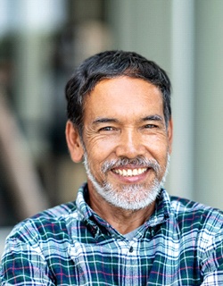 Man smiling after getting direct bonding in Mount Pleasant