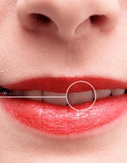 close-up of a woman smiling with a dental implant crown