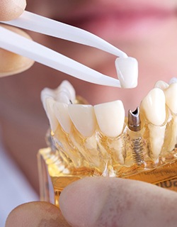 dentist placing a crown on a dental implant 