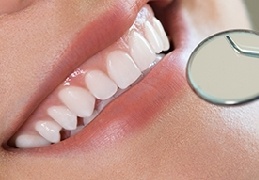 smile with gum disease