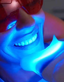 patient undergoing teeth whitening in Mount Pleasant