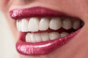 porcelain veneer smile